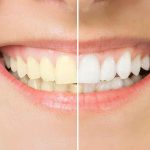 Cosmetic Dentistry- Powerful Technology Can Give You Your Best Smile